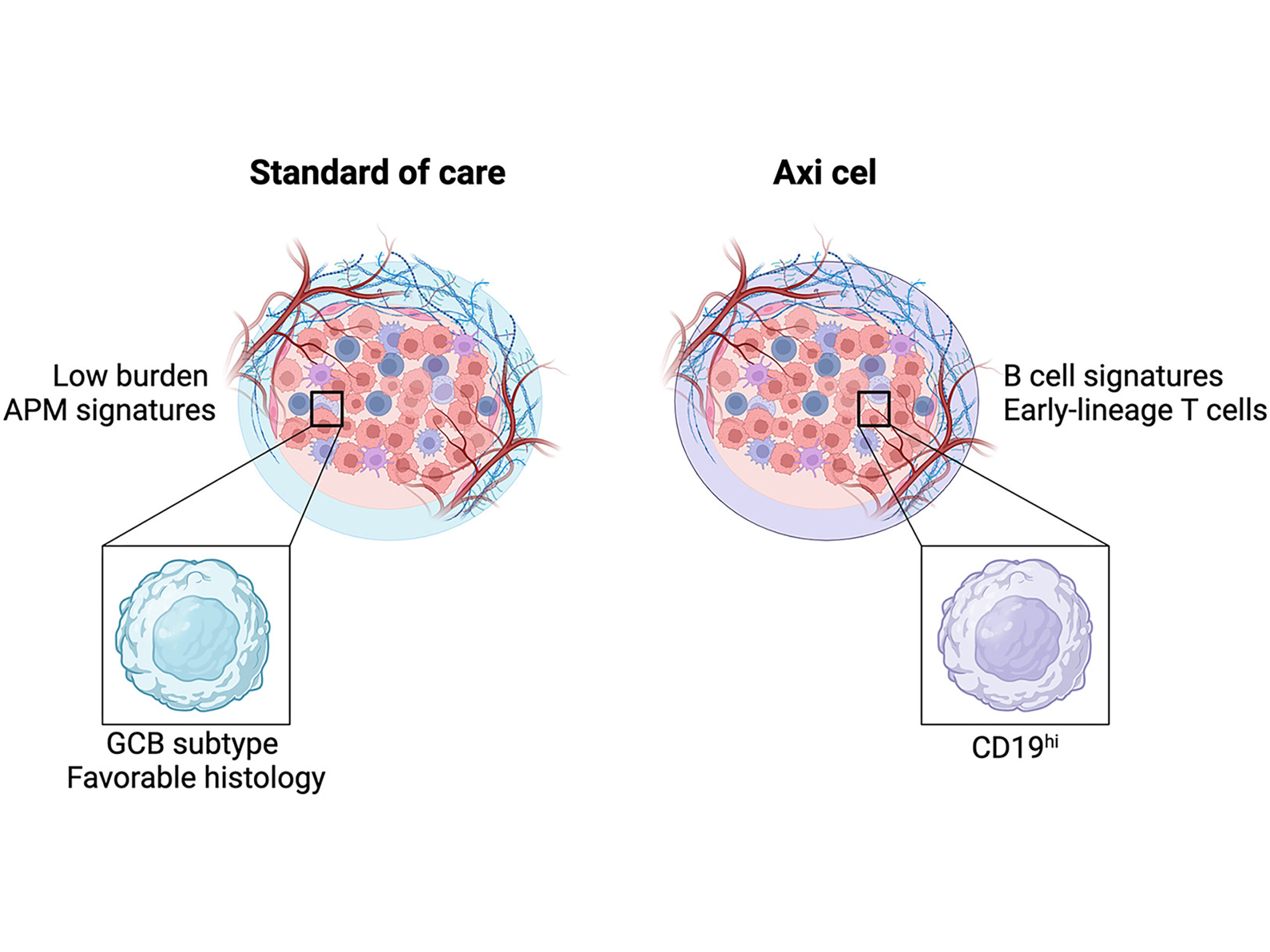 Analysis of pre-treatment tumors reveals gatekeepers of response to CAR T cells